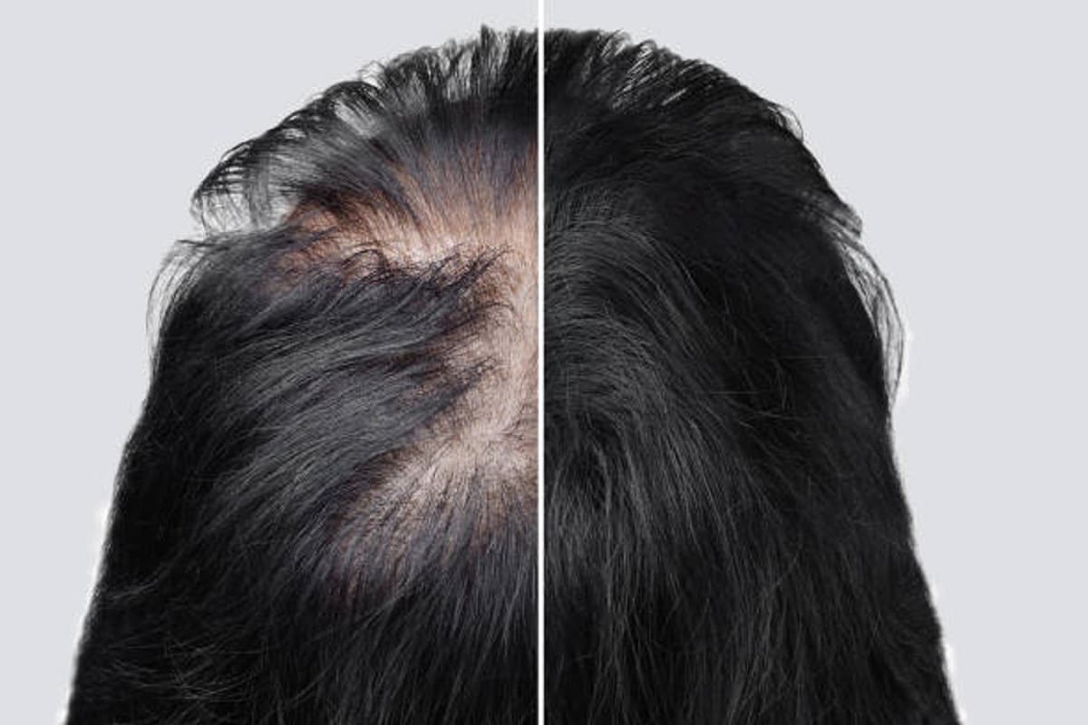 Hair care tips Hair care tips