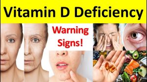 vitamin D deficiency symptoms