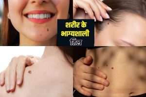 Meaning of Moles on Body