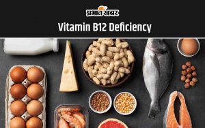 Vitamin B12 Deficiency