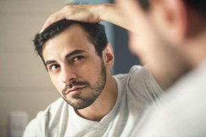 hair loss problem in men