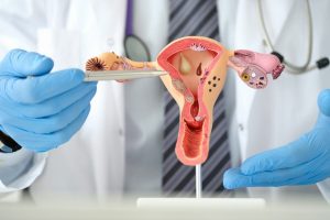 uterus cancer