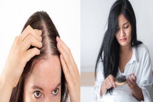 Monsoon Hair Care Tips