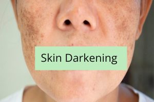 Skin Darkening