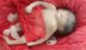 araria news| Bihar News: After Durga immersion, a child with 4 arms and legs was born in Bihar.