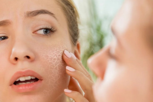 Tips For Dry Skin Care In Winters: सर्दी में रुखेपन के कारण हो रही है असुविधा तो अपनाएं ये टिप्स