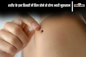 Mole on body which denotes misfortune