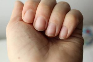 how to remove yellow stains form nail