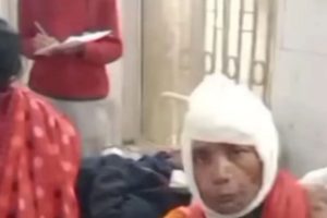 Acid Attack In Muzaffarpur