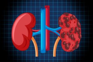 kidney disease